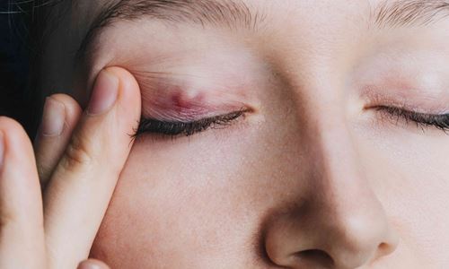 Polikliniska Operationer