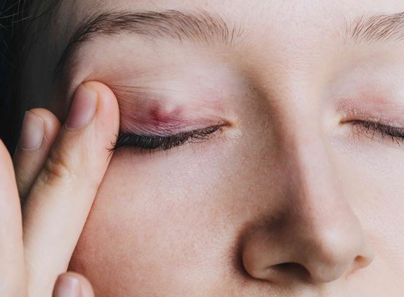 Polikliniska Operationer