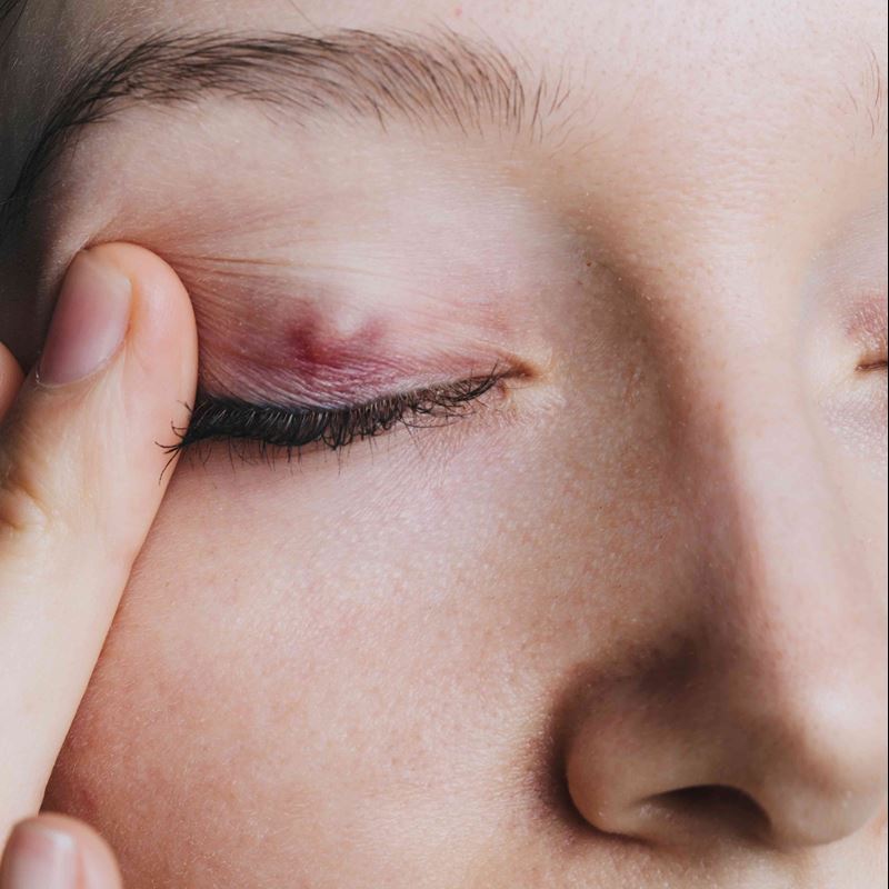 Polikliniska Operationer